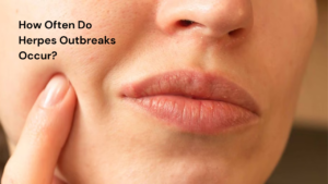How Often Do Herpes Outbreaks Occur?