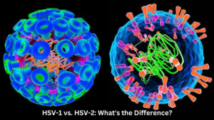 HSV-1 vs. HSV-2: What's the Difference?